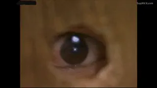 Preview at 02:33